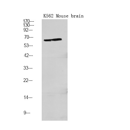 Anti-Phospho-PFKFB2 (Ser466) Polyclonal Antibody