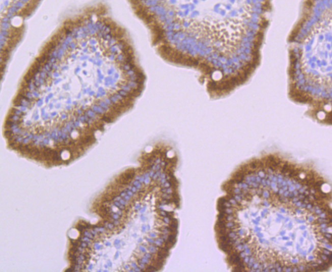 Anti-PERP Antibody (9S923)