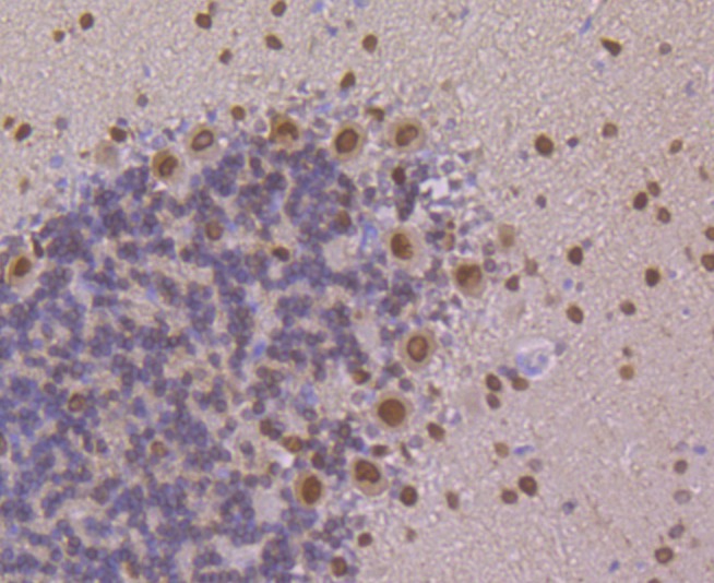 Anti-PSENEN Antibody (3P624)