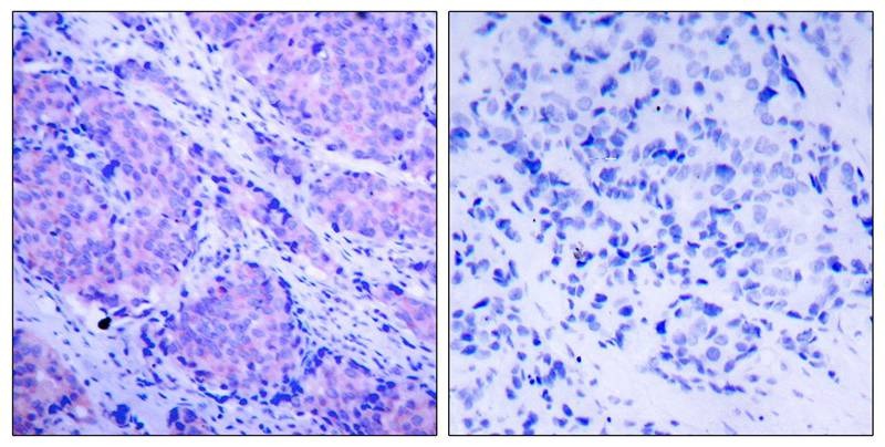 Anti-Phospho-PDK1 (Ser241) Polyclonal Antibody