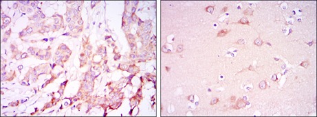 Anti-PDK1 Antibody (4S37)