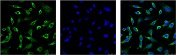 Anti-Peroxiredoxin 1 Antibody (8J261)