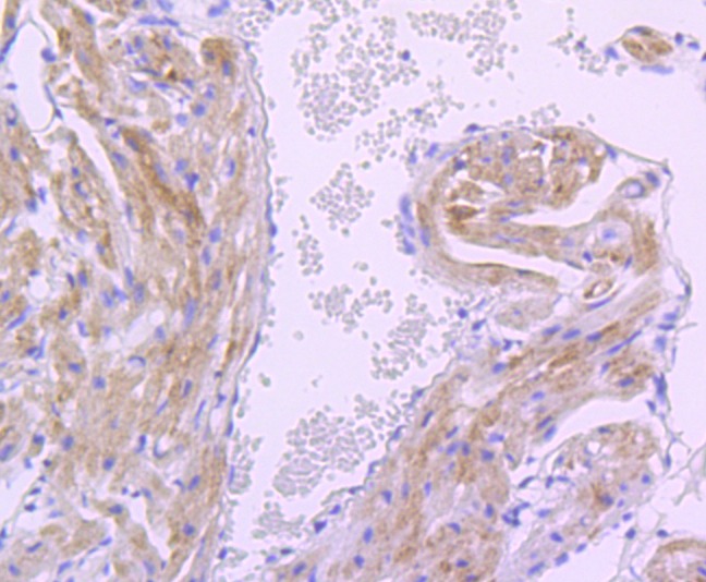 Anti-PDK1 Antibody (2G768)