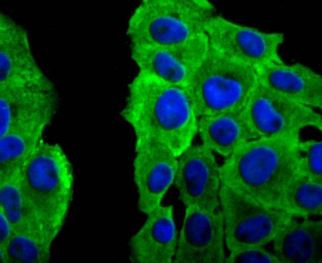 Anti-Peroxiredoxin 2 Antibody (6A598)