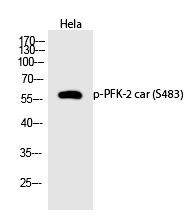 Anti-Phospho-PFKFB2 (Ser483) Polyclonal Antibody