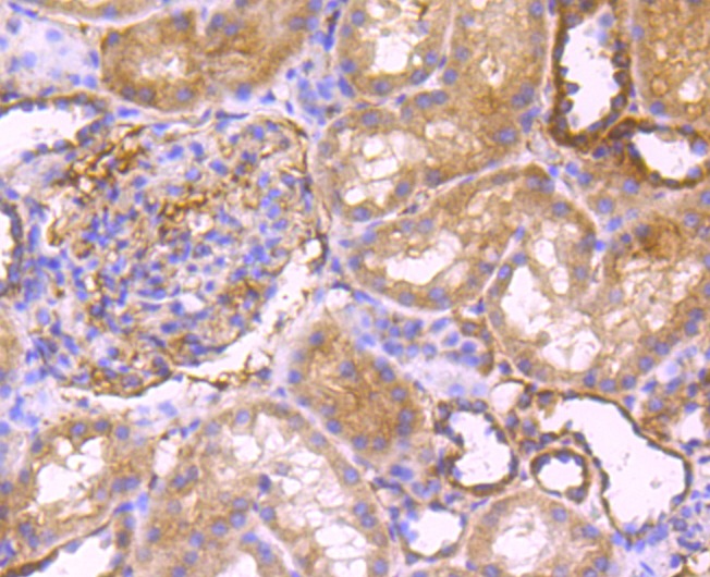 Anti-PRDX3 Antibody (7V569)