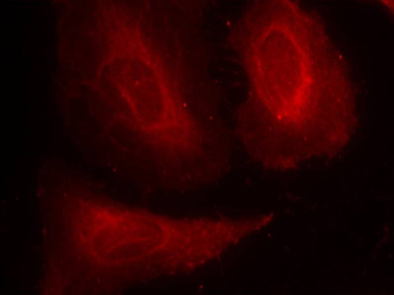 Anti-Phospho-PDK1 (Ser241) Polyclonal Antibody