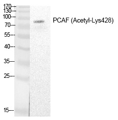 Anti-Acetyl-PCAF (Lys428) Polyclonal Antibody