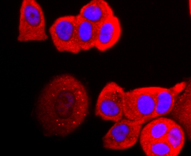 Anti-Perilipin A Antibody (2U427)
