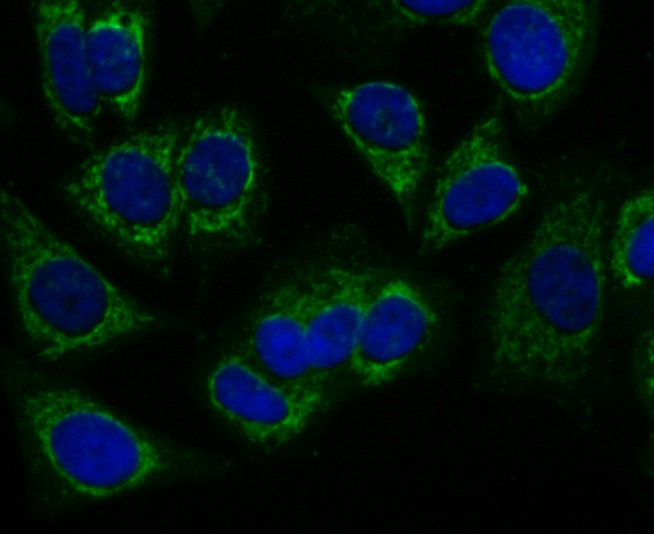 Anti-PRDX3 Antibody (7V569)
