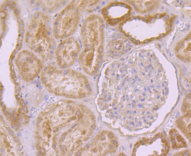 Anti-PSENEN Antibody (3P624)