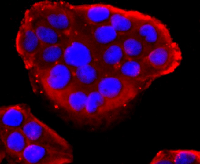 Anti-PDIA6 Antibody (6G49)