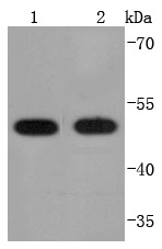 Anti-PDIA6 Antibody (6G49)