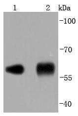 Anti-P4HB Antibody (9K753)
