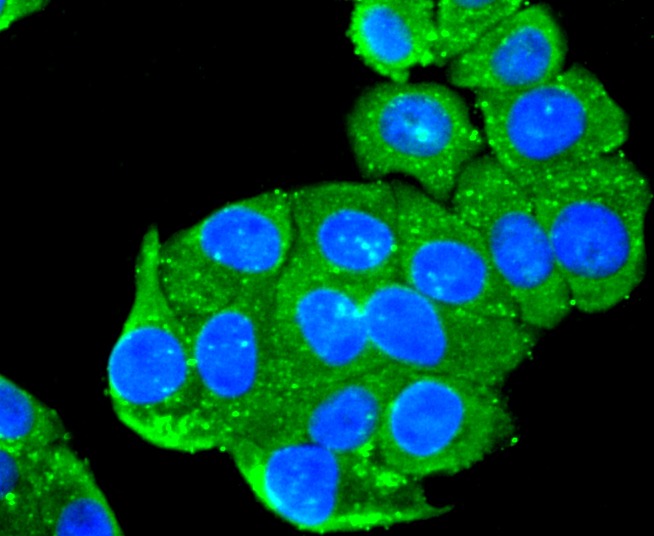 Anti-Peroxiredoxin 1 Antibody (9D82)