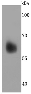 Anti-Perilipin A Antibody (2U427)