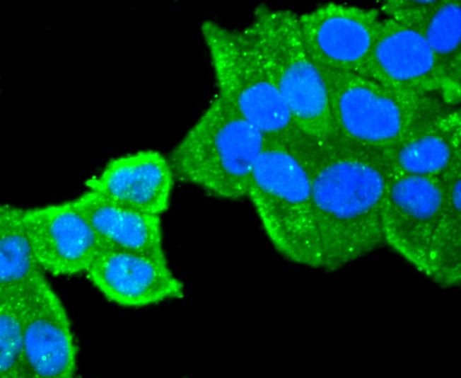 Anti-Peroxiredoxin 1 Antibody (9D82)