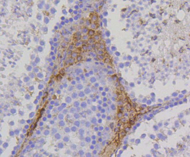 Anti-TSPO Antibody (9Y314)