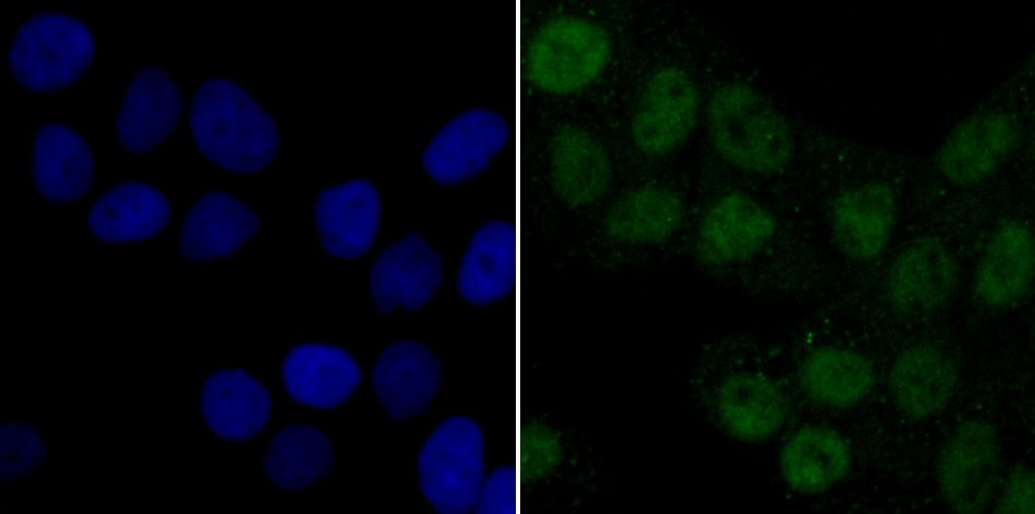 Anti-PDK1 Antibody (2G768)