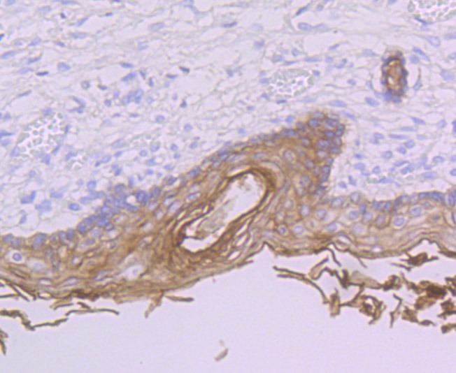 Anti-PERP Antibody (9S923)