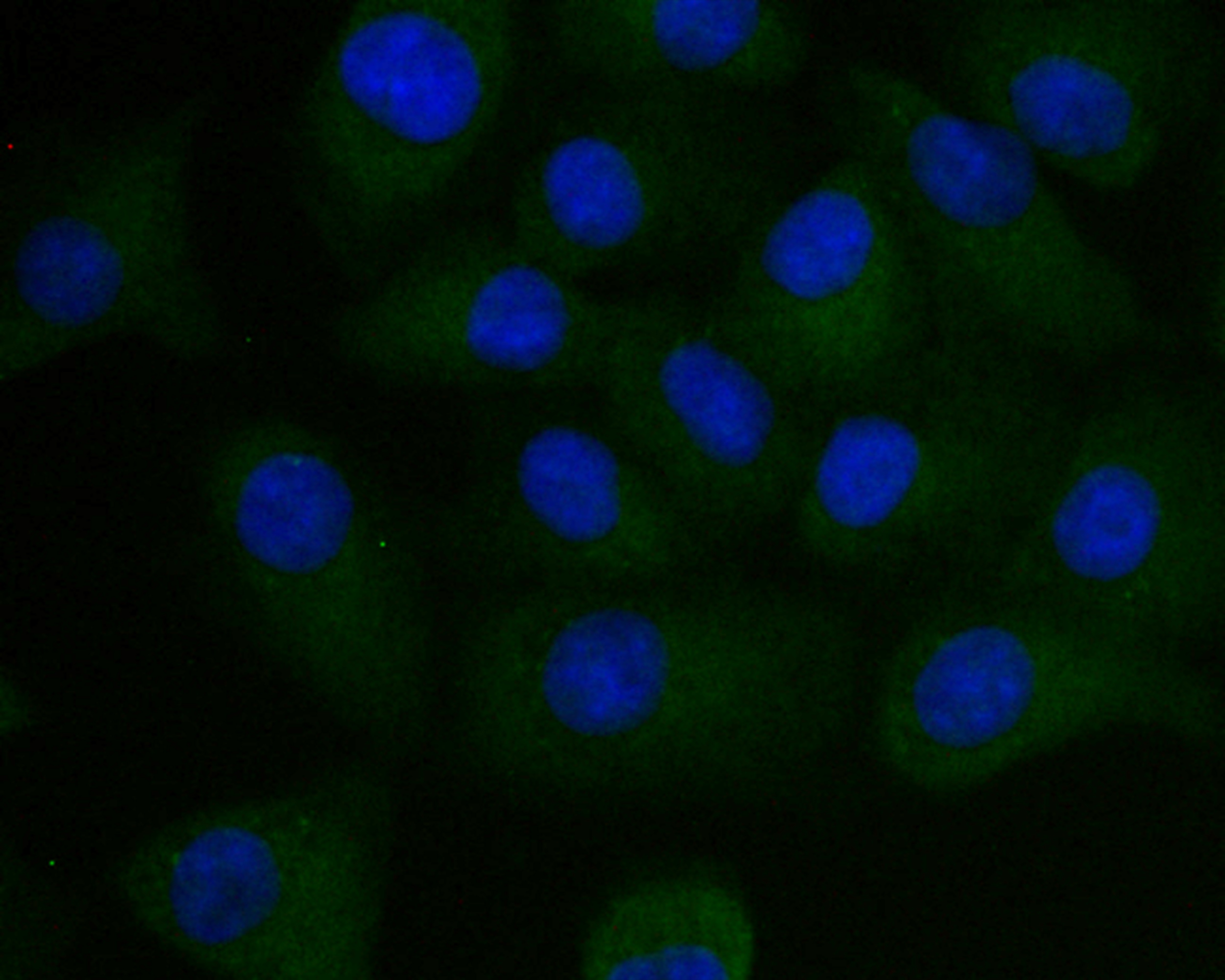 Anti-PSENEN Antibody (3P624)