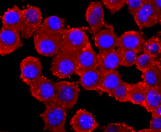 Anti-PRKN Antibody (1X34)