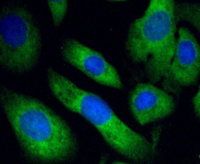 Anti-EGLN2 Antibody (7L776)