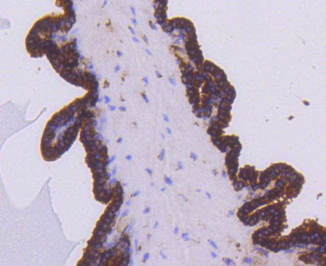 Anti-EGLN2 Antibody (7L776)
