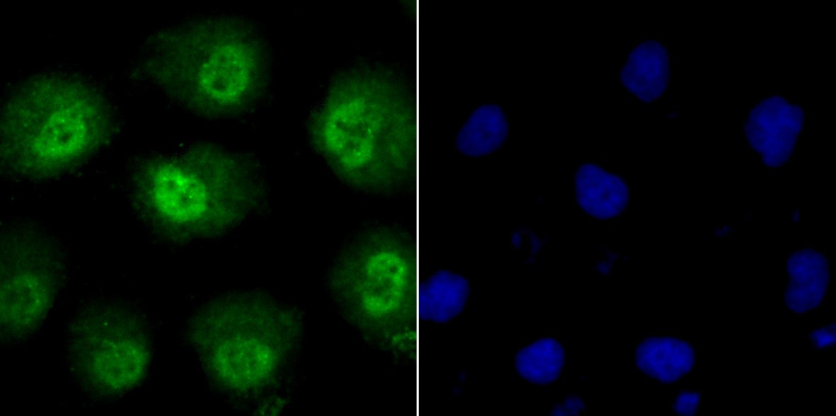Anti-Phospho-Alpha-Synuclein (Ser129) Antibody (7E158)