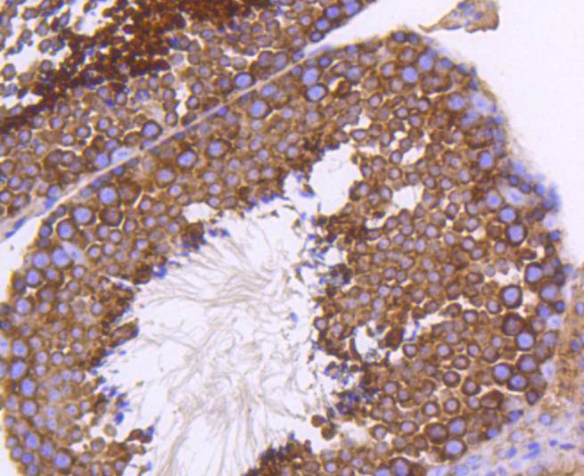Anti-EGLN2 Antibody (7L776)