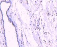 Anti-Phospho-AKT1 (Thr450) Antibody (2R55)