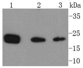 Anti-PARK7/DJ1 Antibody (9Q473)