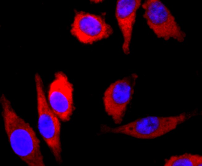 Anti-PRKN Antibody (1X34)