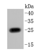 Anti-UCHL1 Antibody (2X729)
