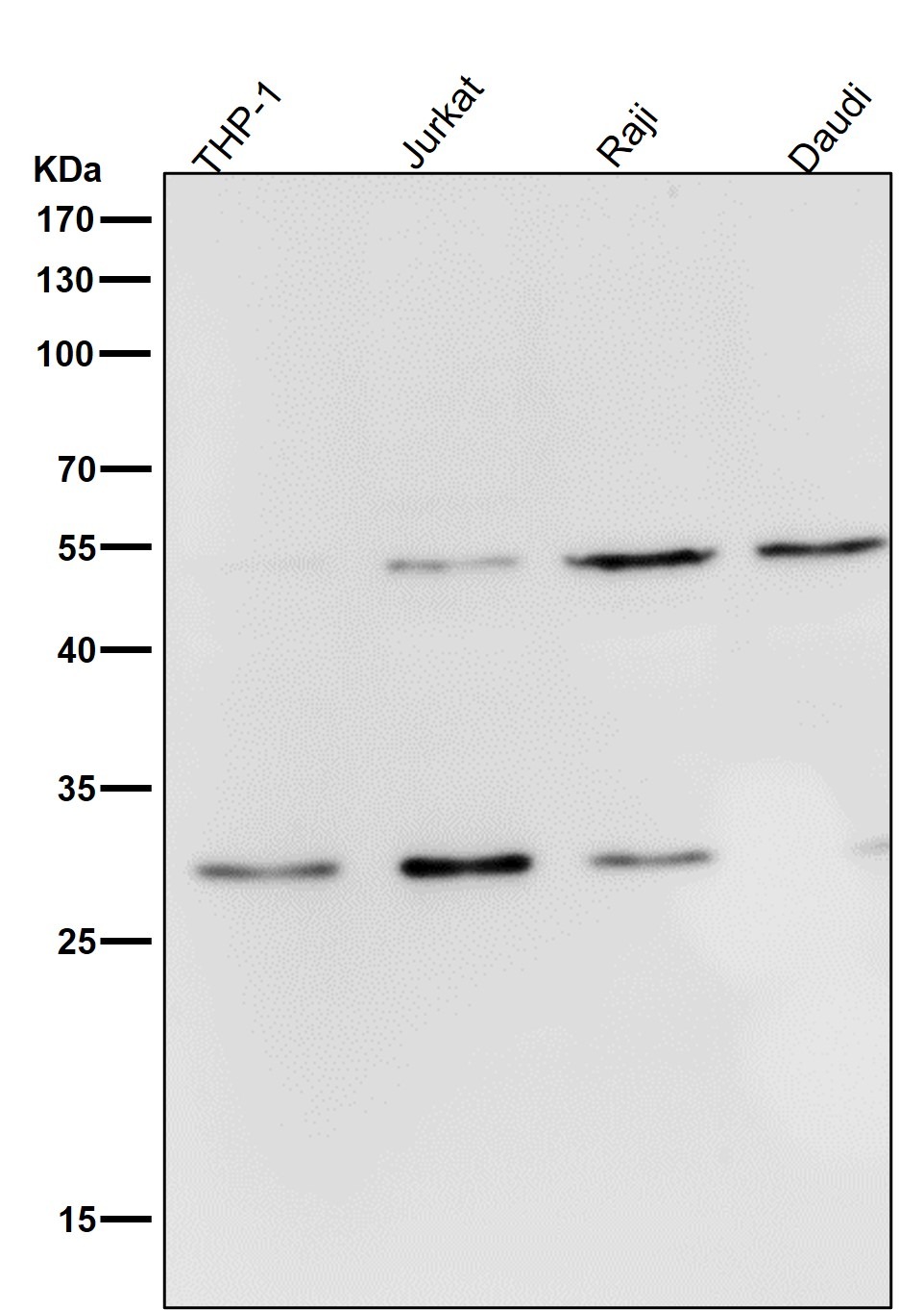 Anti-PRKN Antibody (1X34)