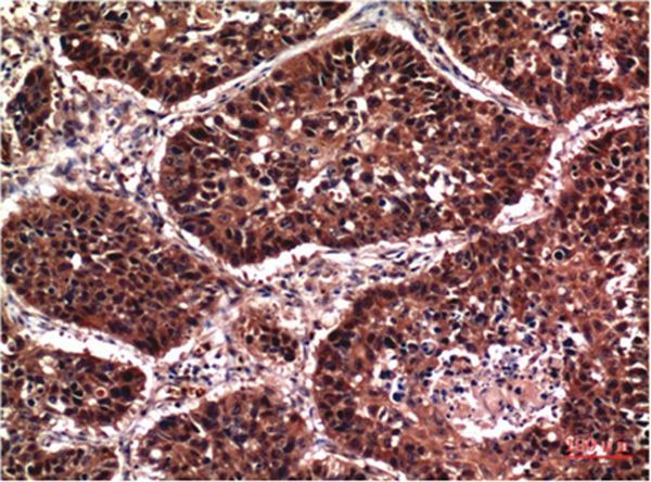 Anti-Phospho-AKT1 (S473) Antibody (6W615)