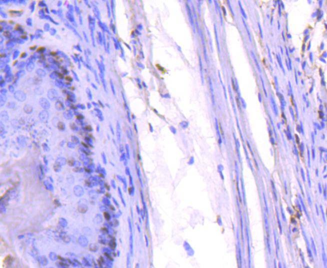 Anti-PCNA Antibody (2C751)