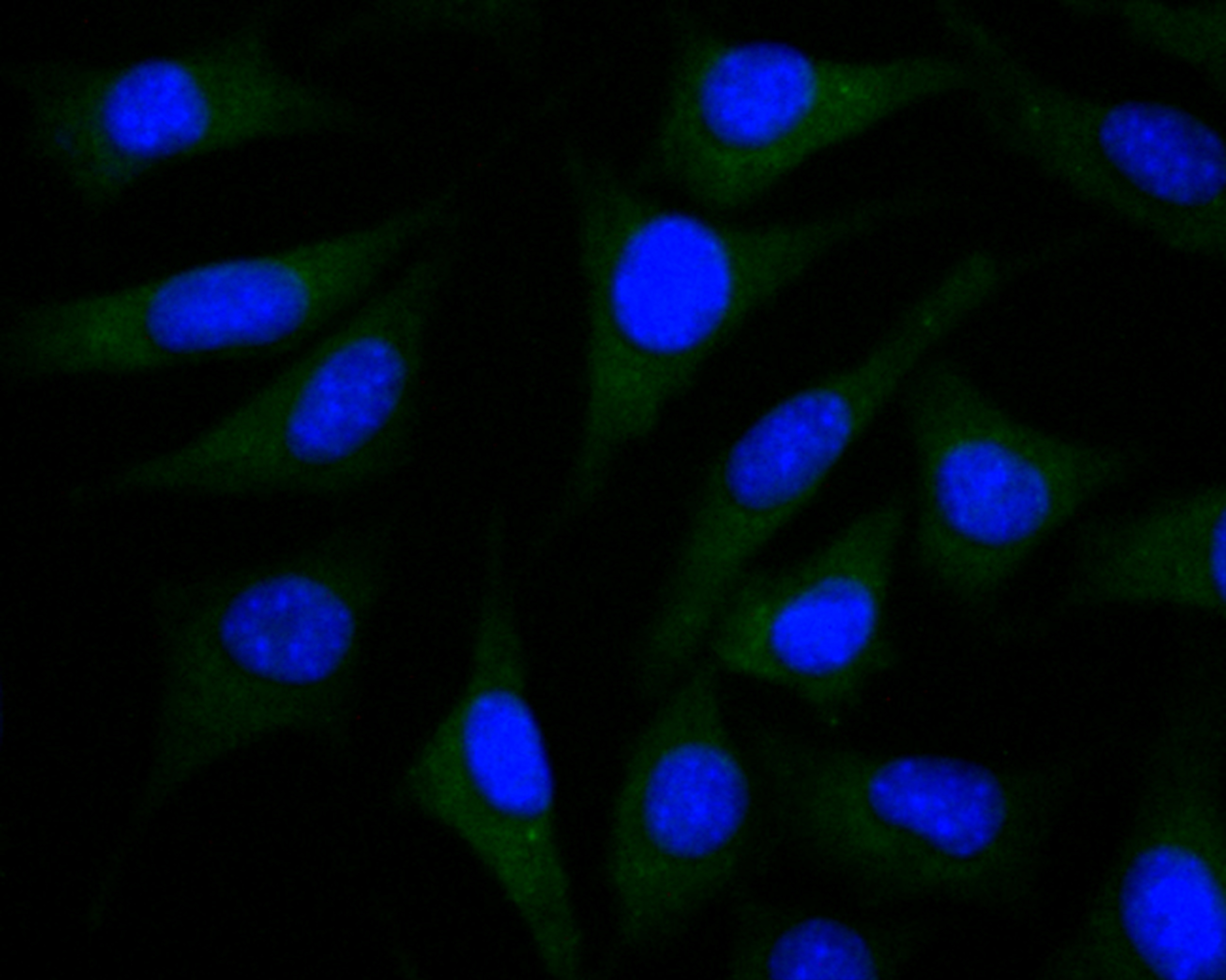 Anti-PSENEN Antibody (3P624)