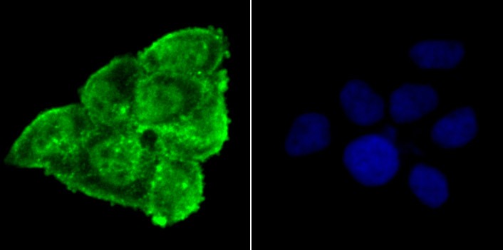 Anti-Phospho-Alpha-Synuclein (Ser129) Antibody (7E158)