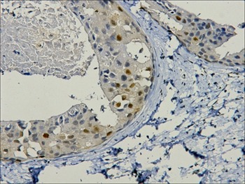 Anti-PCNA Antibody (5V918)
