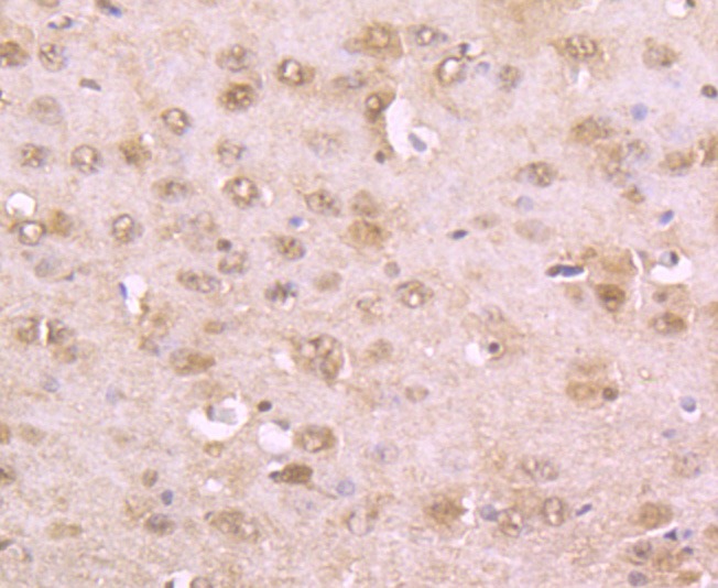 Anti-Phospho-Alpha-Synuclein (Ser129) Antibody (7E158)