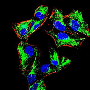 Anti-PRDM1 Antibody (4L235)