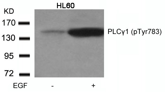 Anti-Phospho-PLCγ1 (Tyr783) Polyclonal Antibody