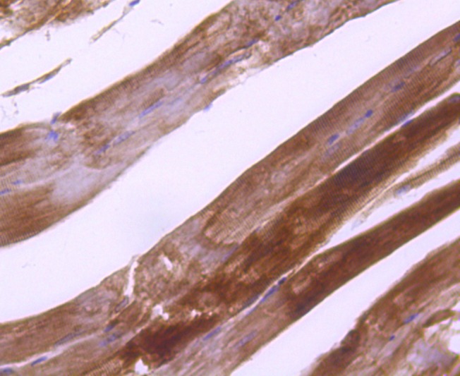 Anti-Plectin Antibody (4J312)