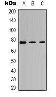 Anti-Phospho-PKC iota/PRKCZ (Thr412/410) Polyclonal Antibody
