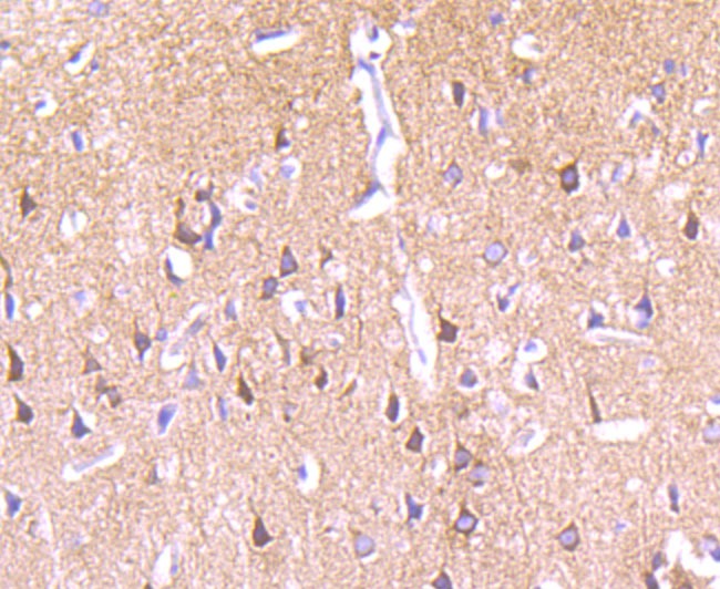 Anti-PKCE Antibody (5H978)