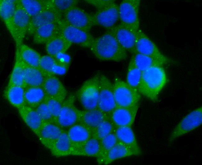 Anti-PKCE Antibody (5H978)