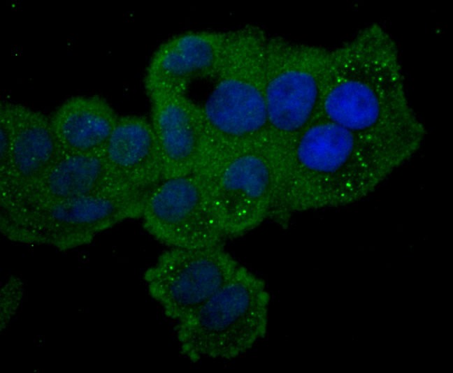 Anti-PKCE Antibody (5H978)