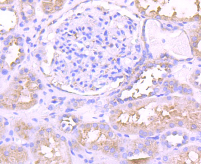 Anti-PKCE Antibody (5H978)