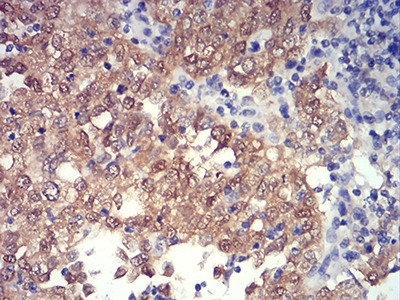 Anti-PRDM4 Antibody (8D792)